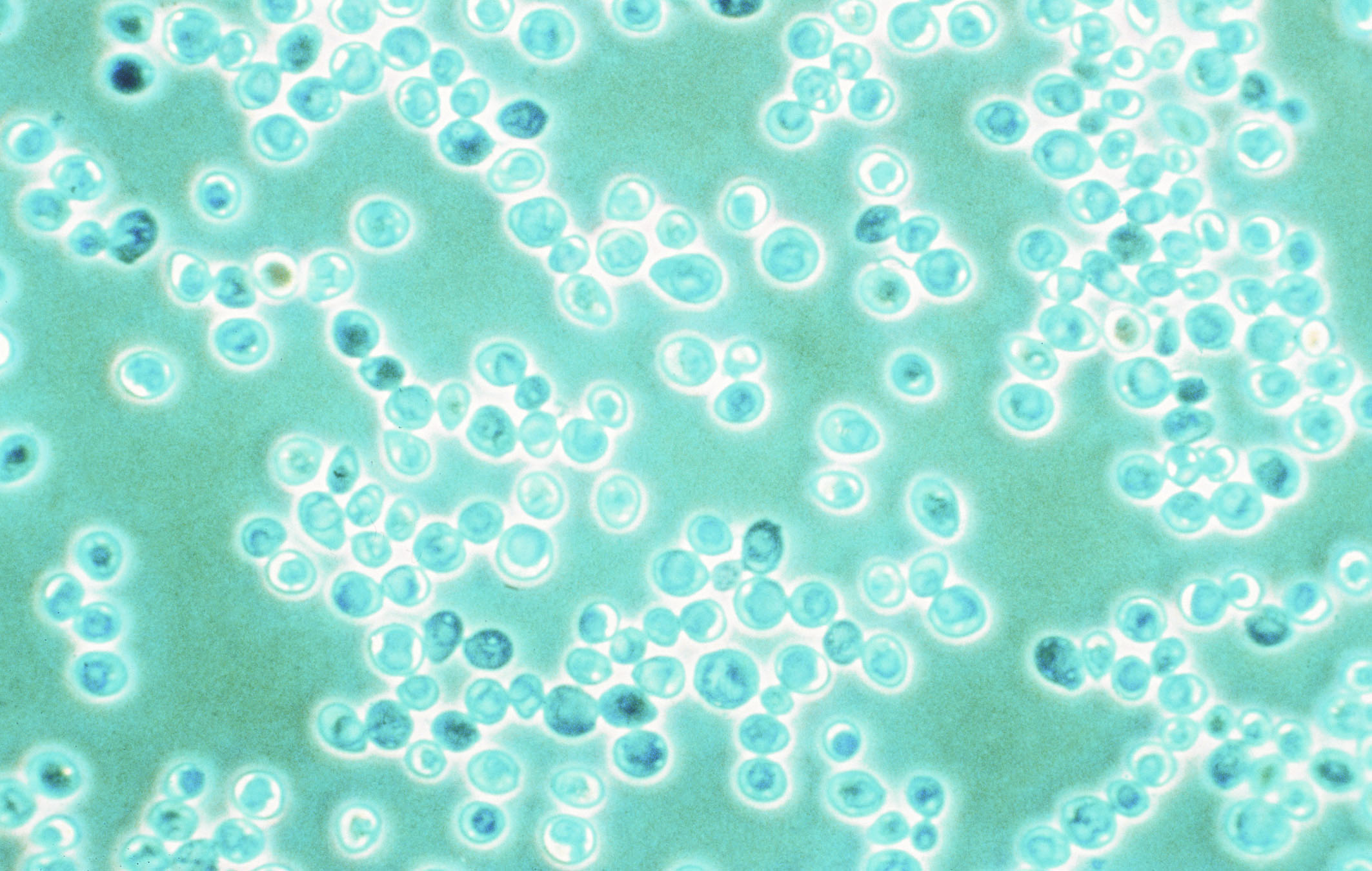 beer yeast strains for beer fermentation